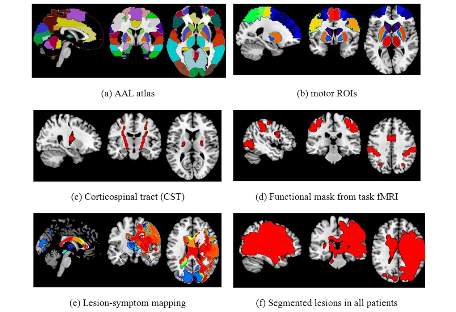 First page of Decoding Post-Stroke Motor Function paper